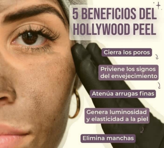 Carbon Peeling